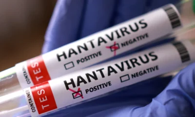 Hantavirus en Venezuela