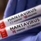 Hantavirus en Venezuela